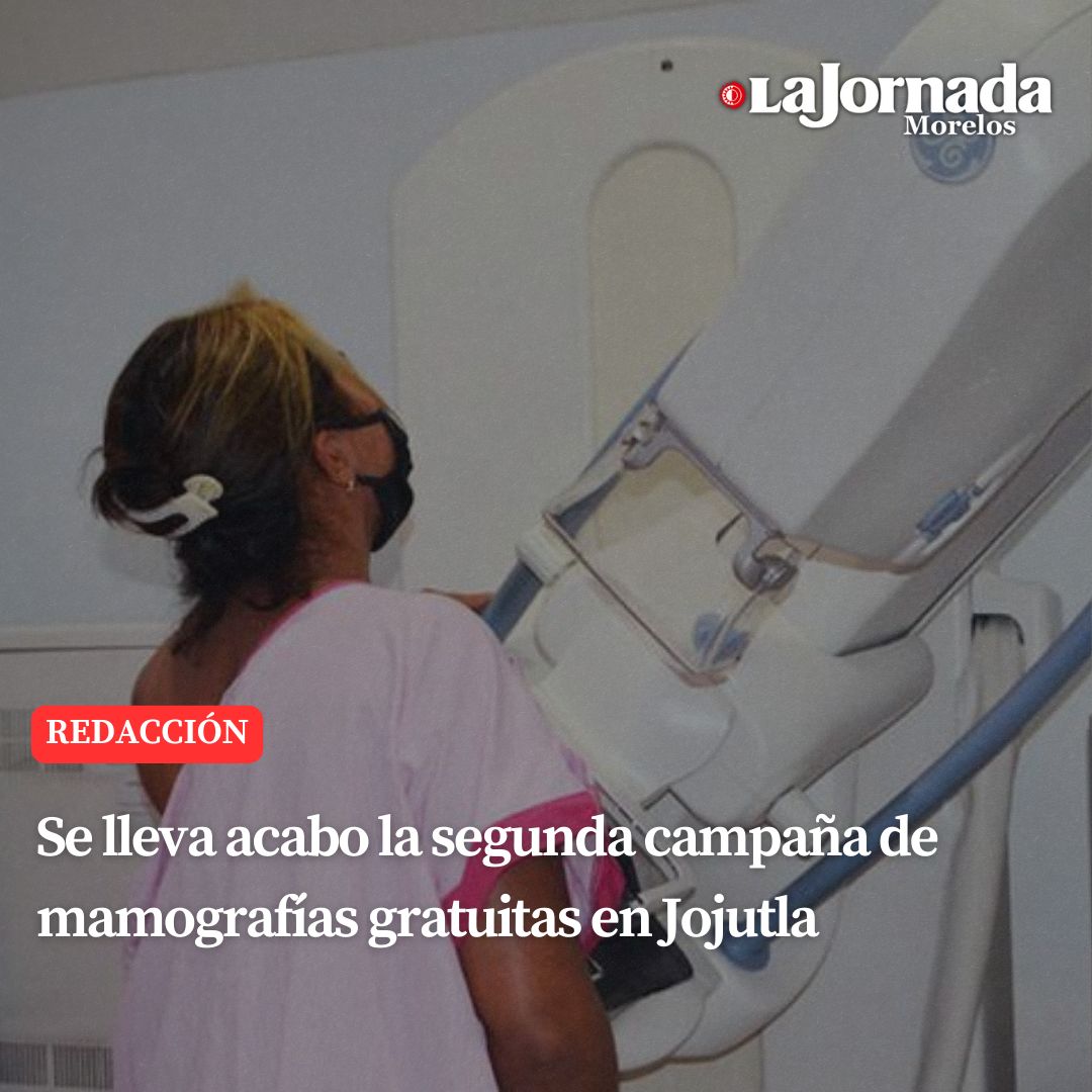 Se lleva a cabo la segunda campaña de mamografías gratuitas en Jojutla