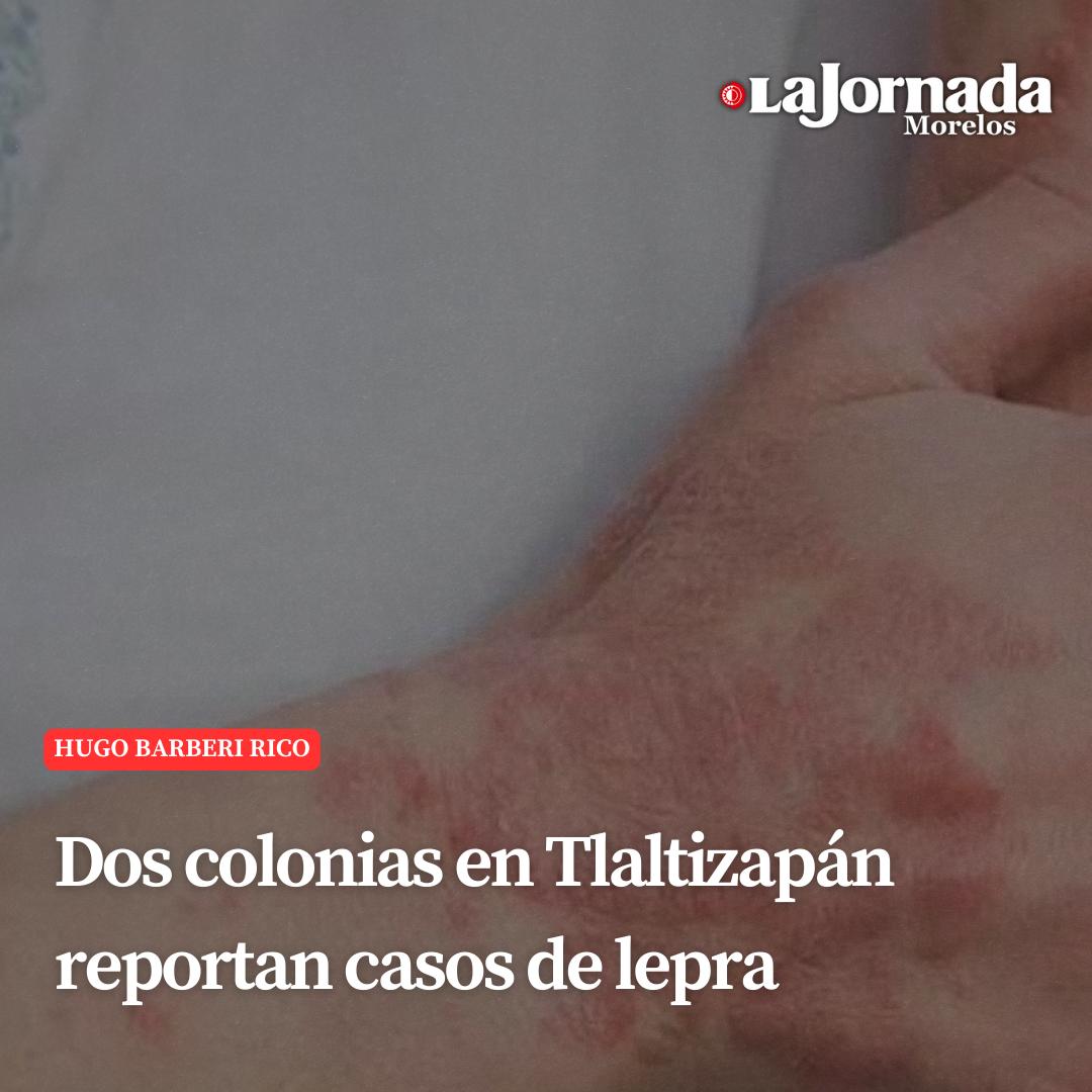 Dos colonias en Tlaltizapán reportan casos de lepra