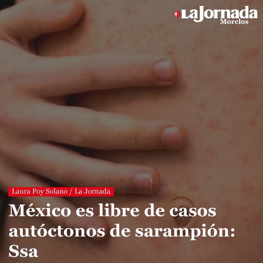 México es libre de casos autóctonos de sarampión: Ssa
